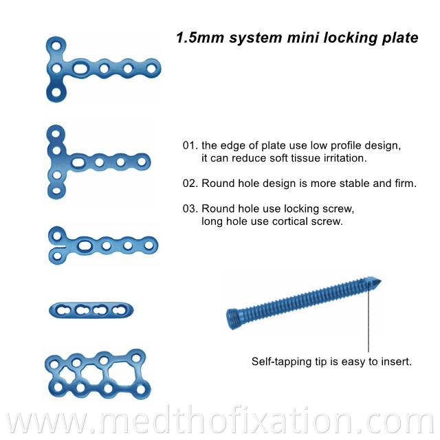 1.5mm locking plate system